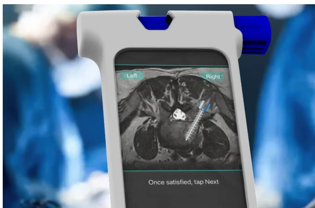 The Bolt Navigation Unit's touchscreen planner in the OR