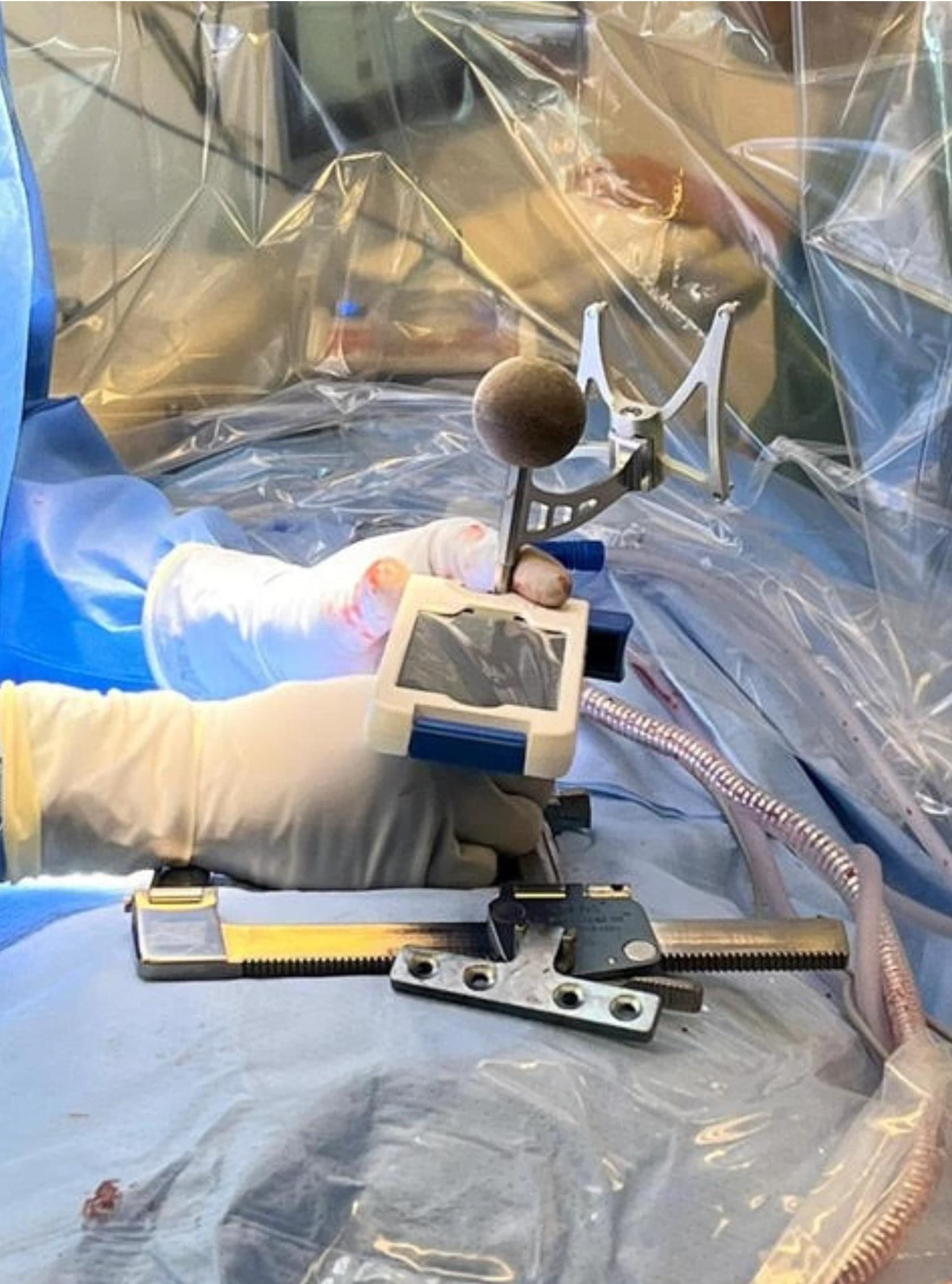 The Bolt Navigation Unit and instrumentation in the surgical field